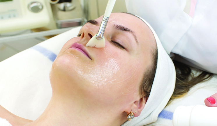 Acne Scars Treatment: Skin Peel