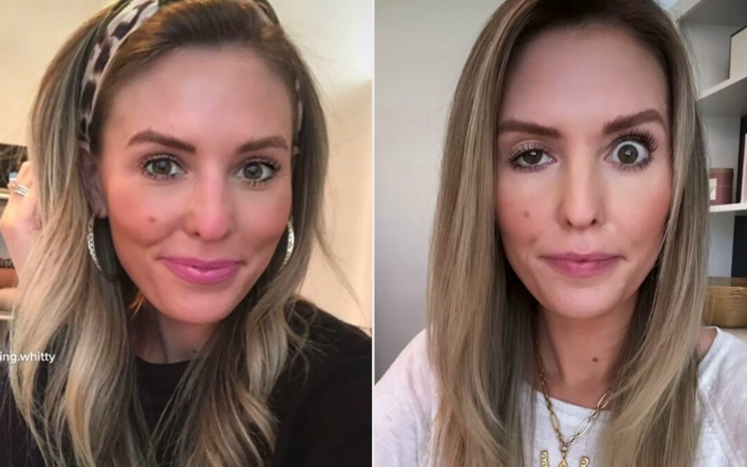What can go wrong with Botox?