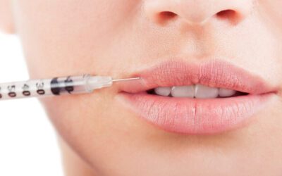 10 Things You Need To Know About Lip Fillers