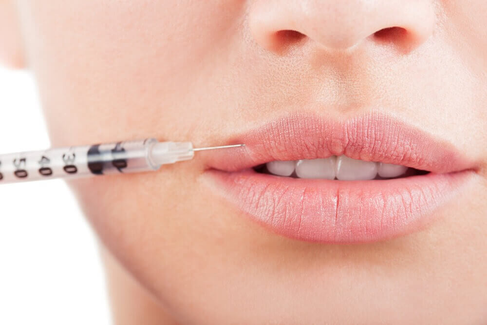 10 Things You Need To Know About Lip Fillers