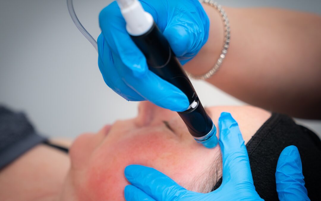 Hydrafacial vs Microdermabrasion – Which Is Better?