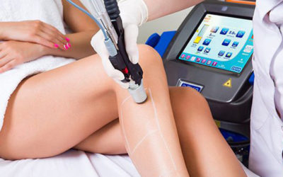 Why get laser hair removal at our Wrexham clinic?