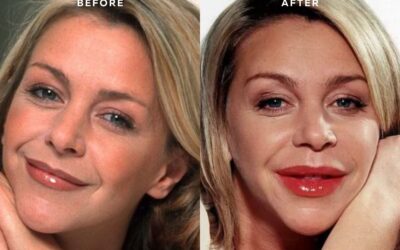 Leslie Ash Lips