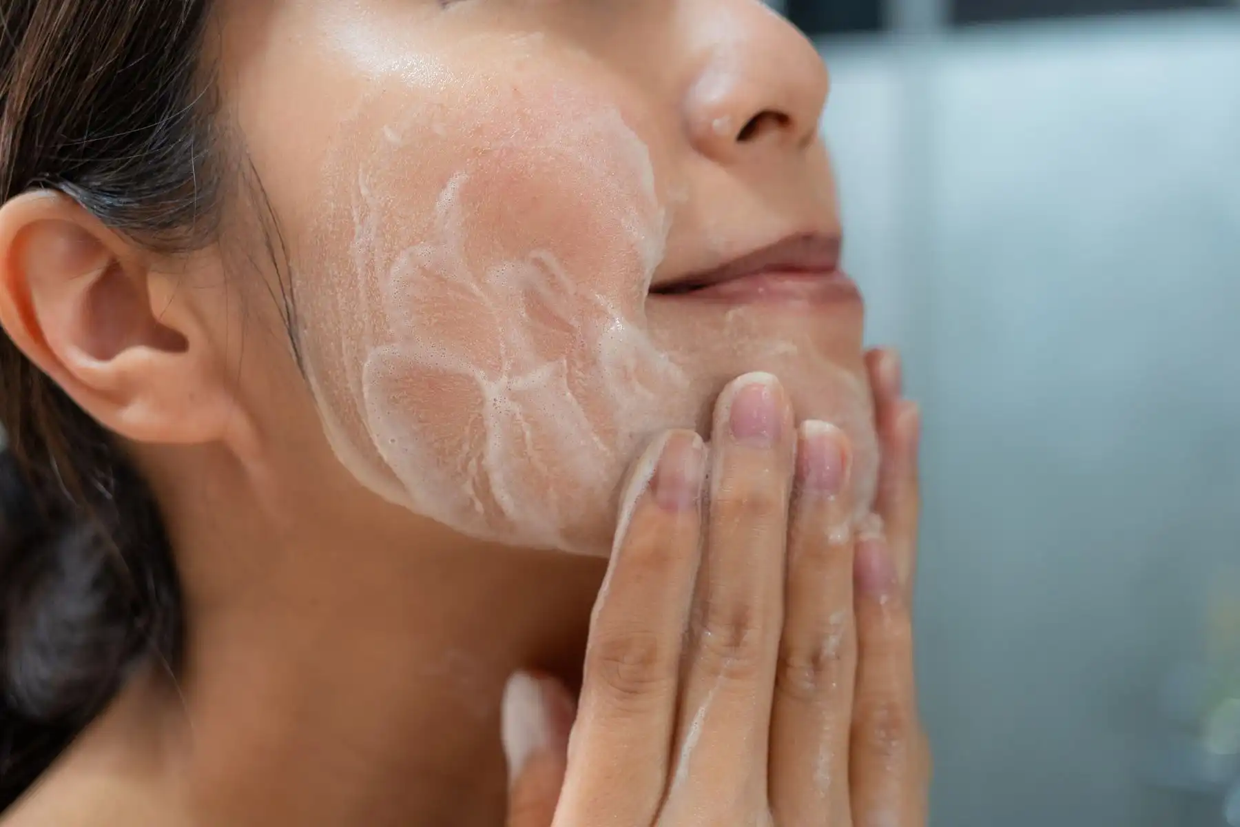 Acne washing your face too often