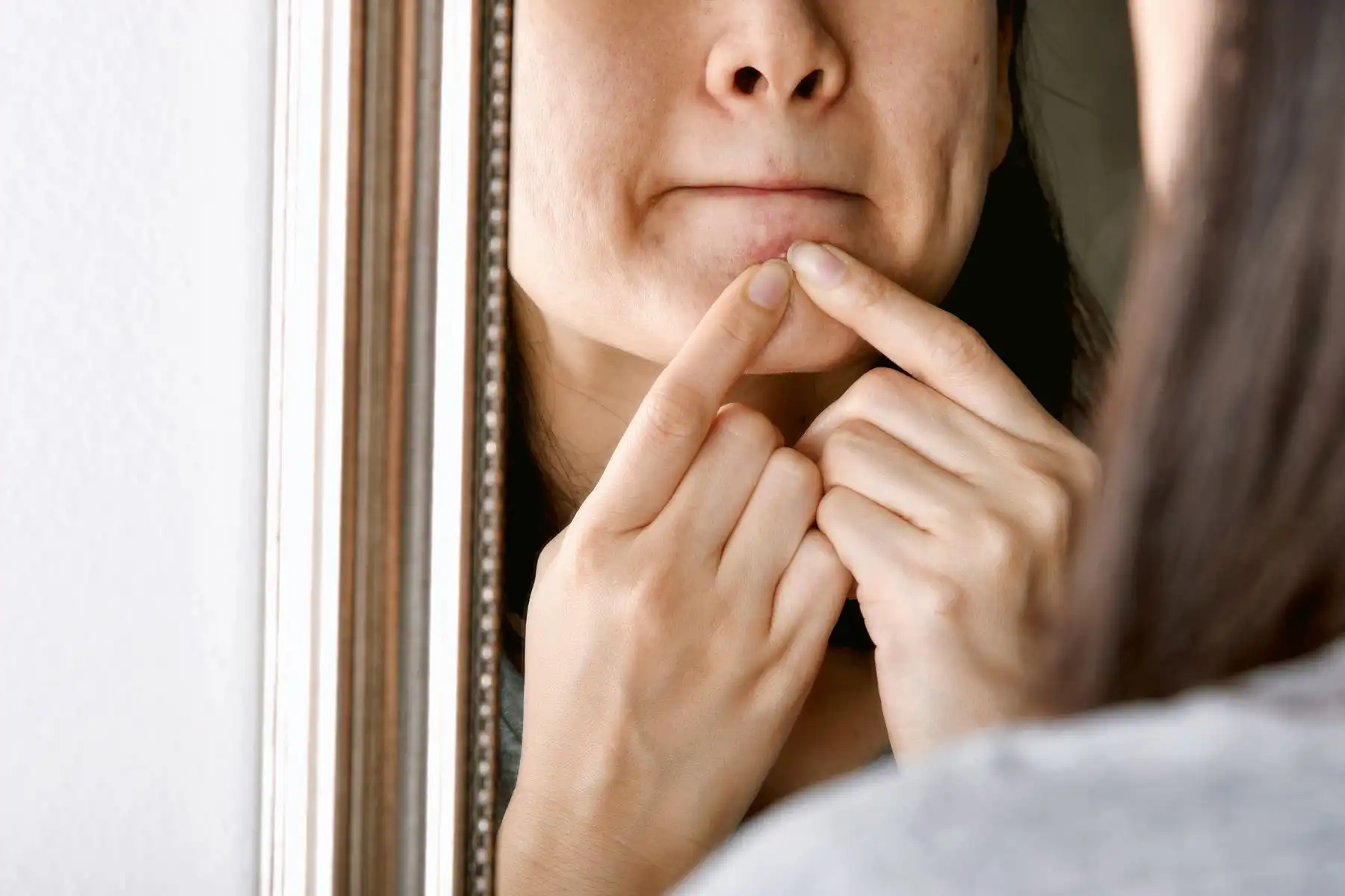 Popping pimples and picking spots