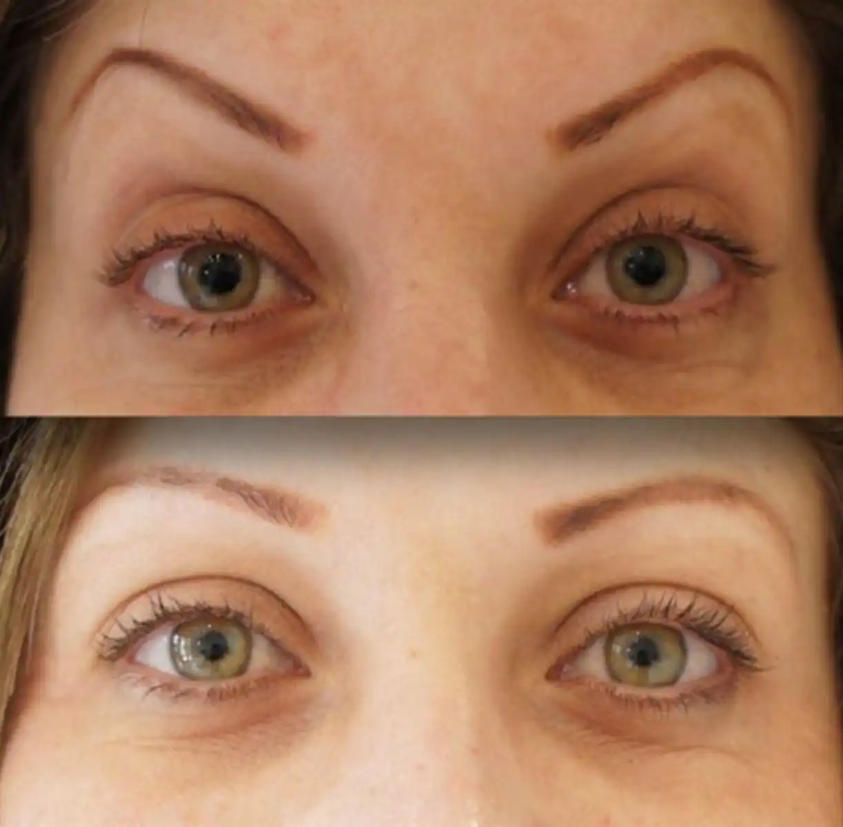 Spock Brow