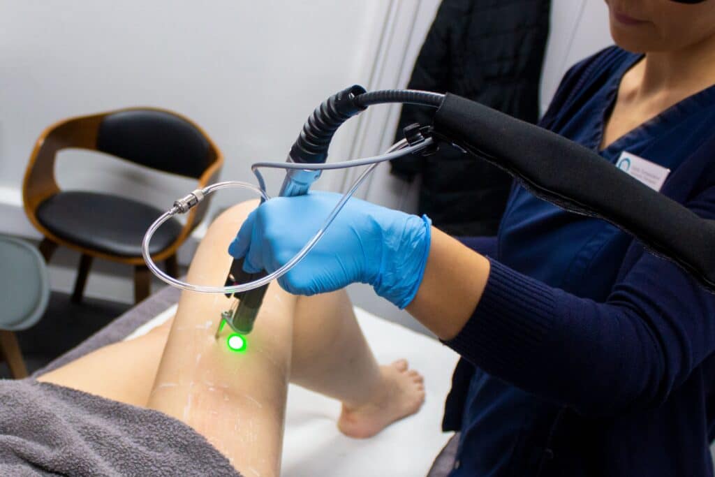 Laser Hair Removal with the Motus AY at Freyja Medical