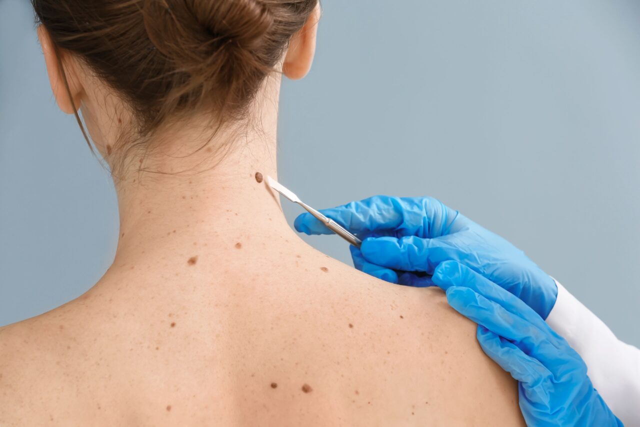 Dermatology Services - Freyja Medical