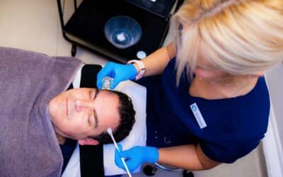 Skin Peels for Acne Scarring: How They Work