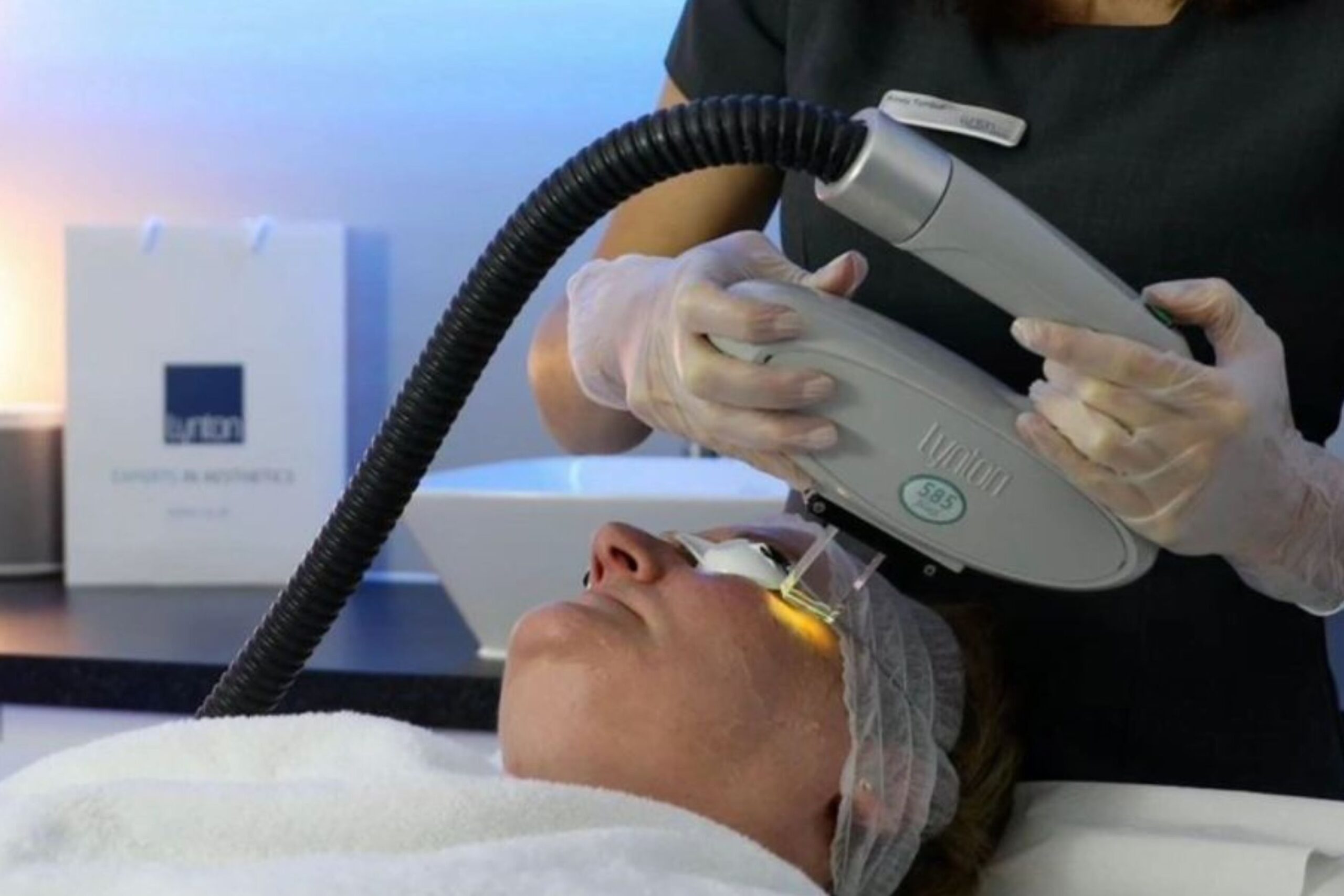 IPL / Laser therapy for for uneven skin tone and pigmentation at Freyja Medical in Wrexham, Nantwich and Cheshire