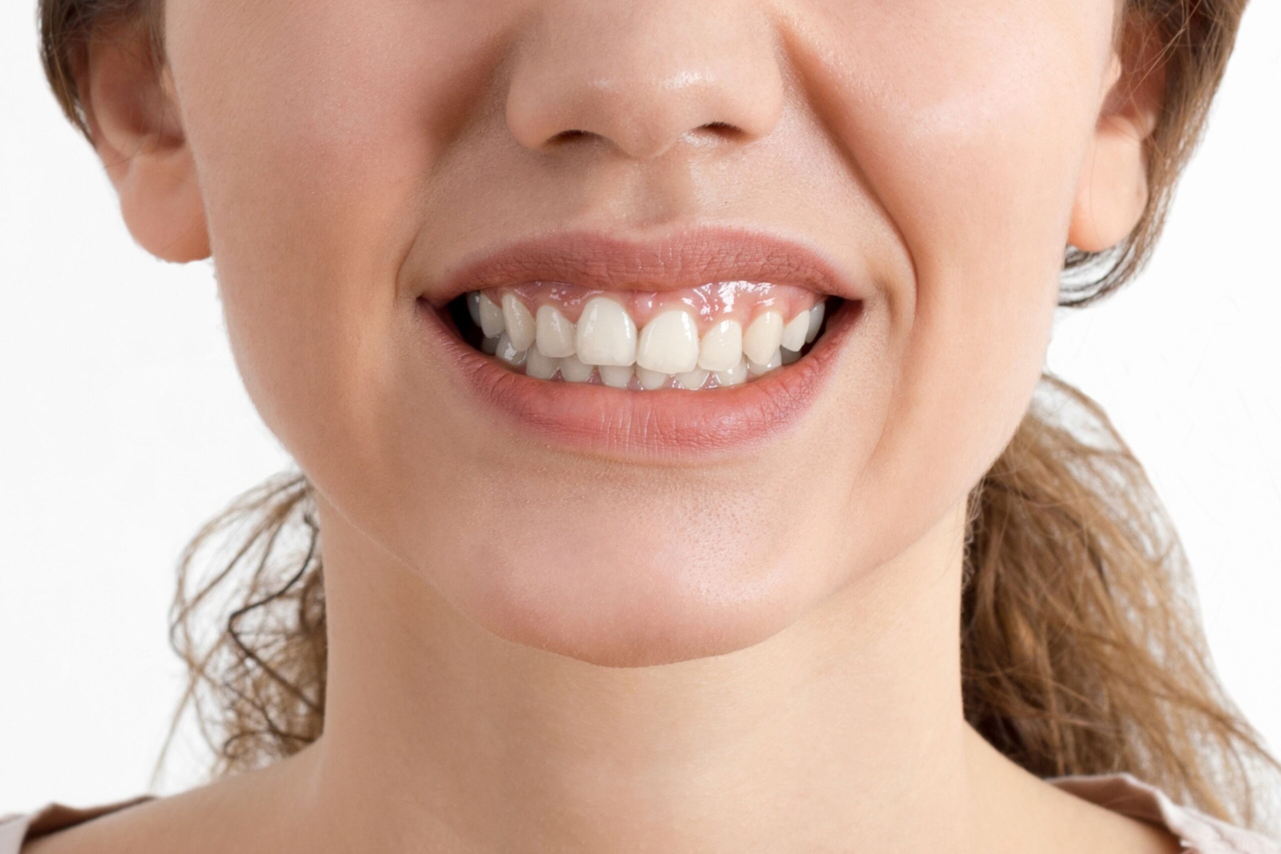 Teeth Clenching / Teeth Grinding / Bruxism
