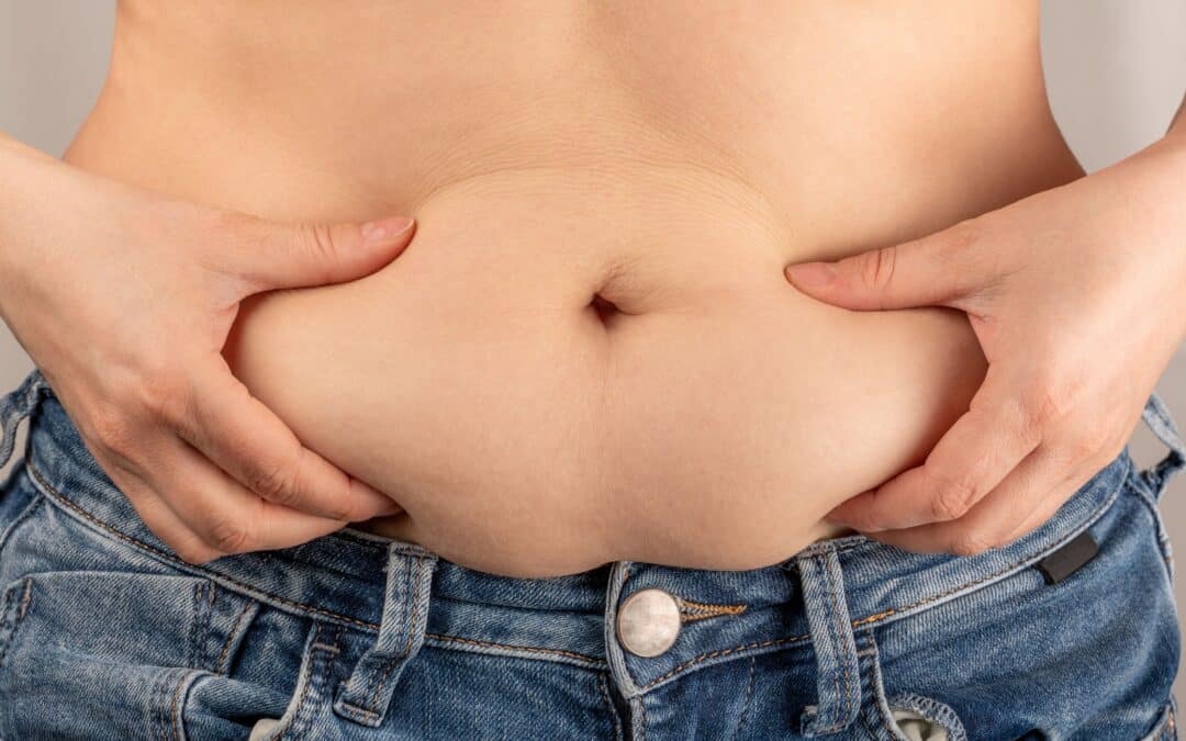 Fat in the Lower Abdomen: Why It Can Be So Difficult to Shift
