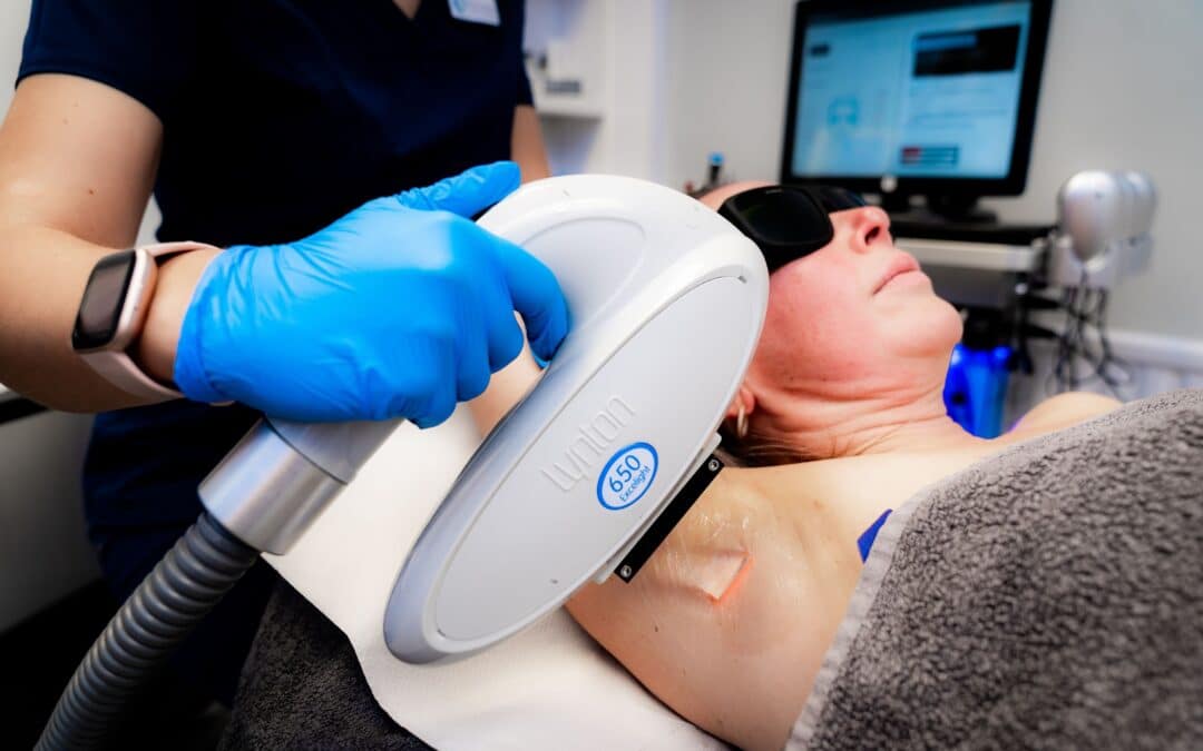 Hair Removal in Crewe and Nantwich