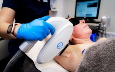 Hair Removal in Crewe and Nantwich