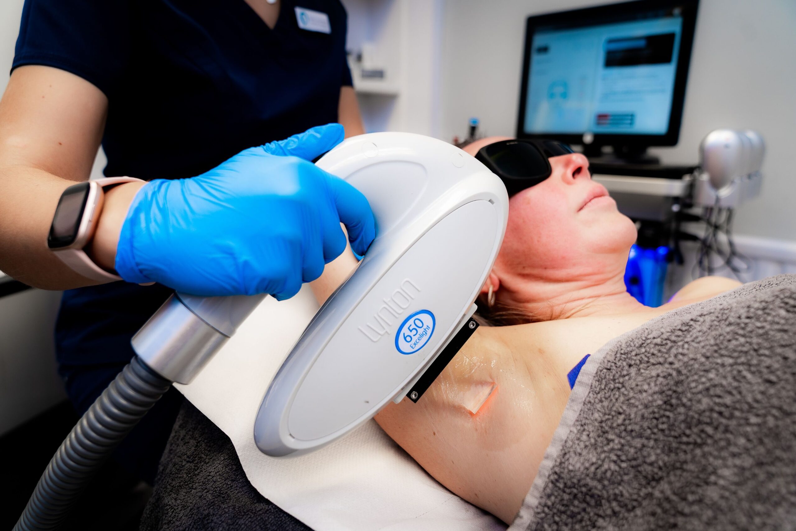 IPL treatments for unwanted hair at Freyja Medical in Wrexham, Nantwich and Cheshire