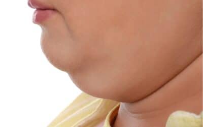 Thin With Double Chin: Why It Happens and What Can Help