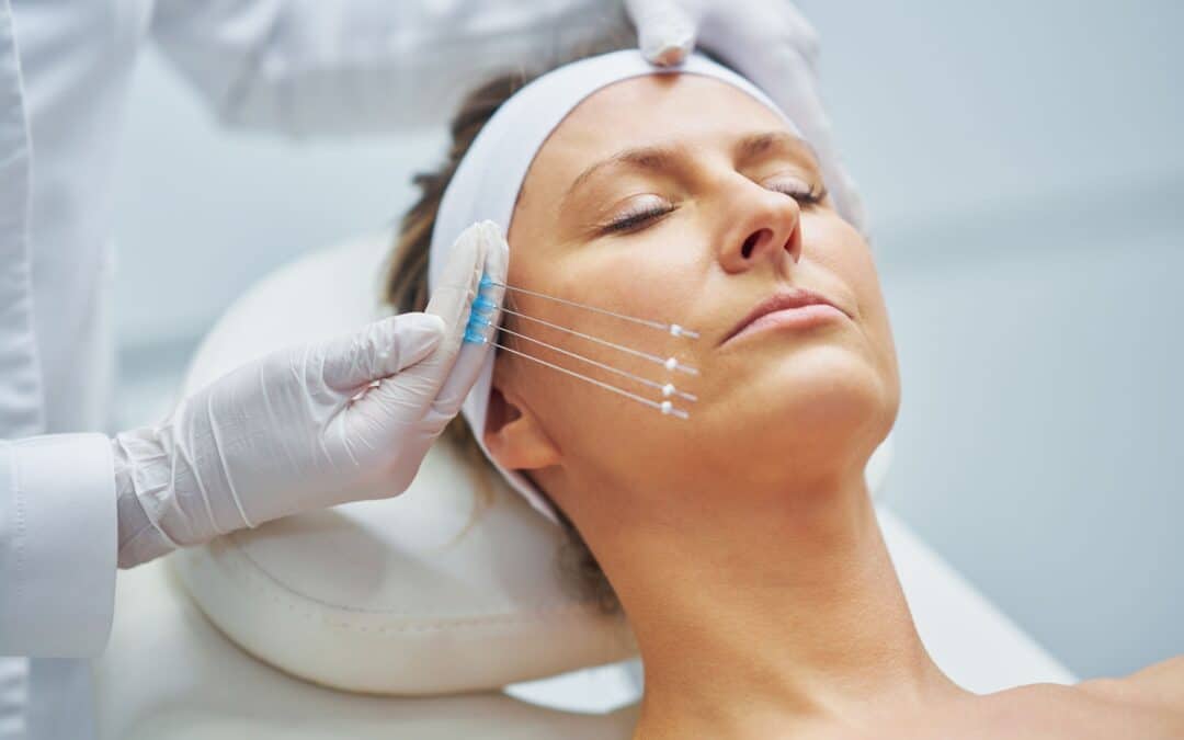 Transform with Silhouette Soft Thread Lifts