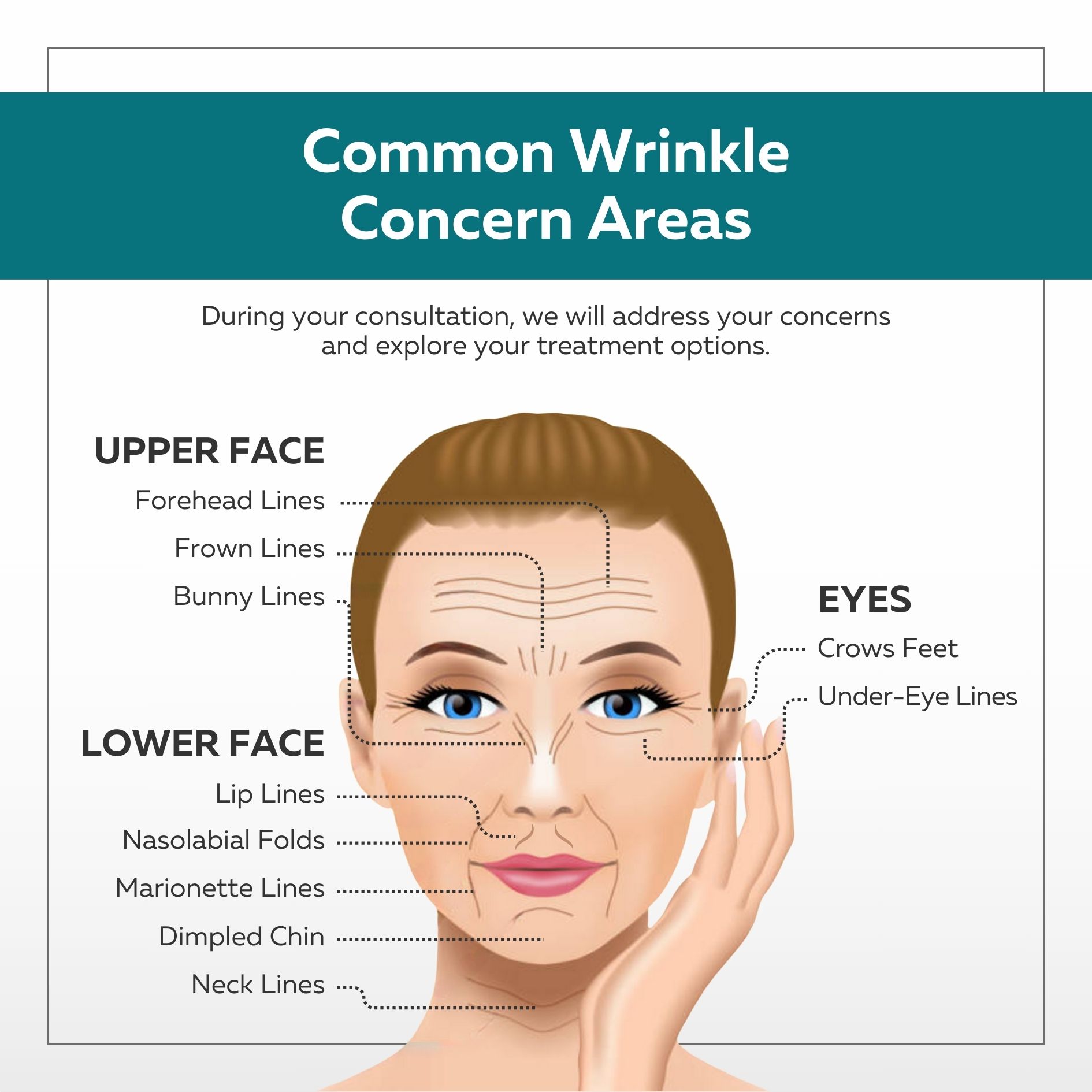 Labelled diagram of Woman's face with wrinkles, to depict common wrinkle concern areas