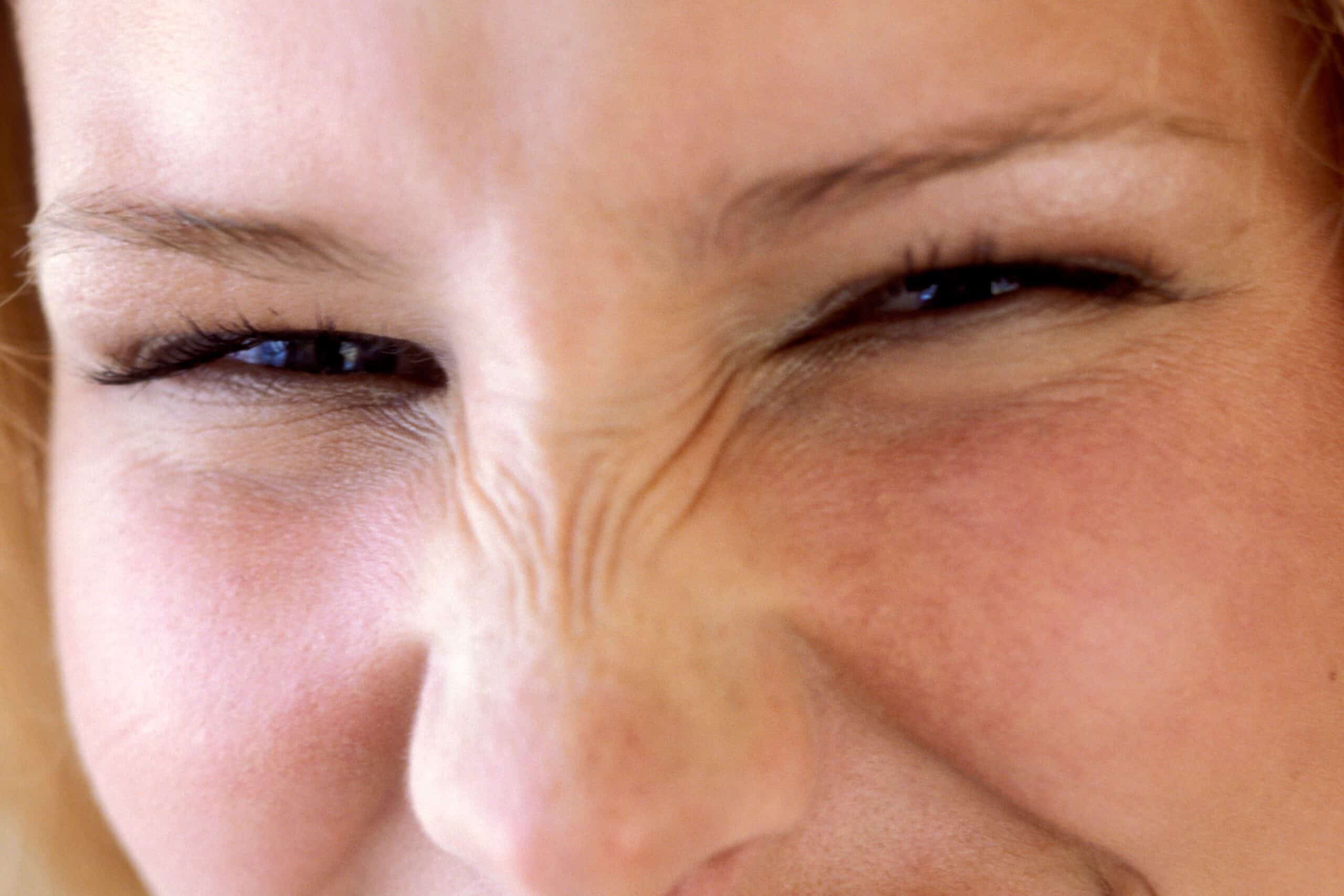 Bunny Lines / Nose Lines