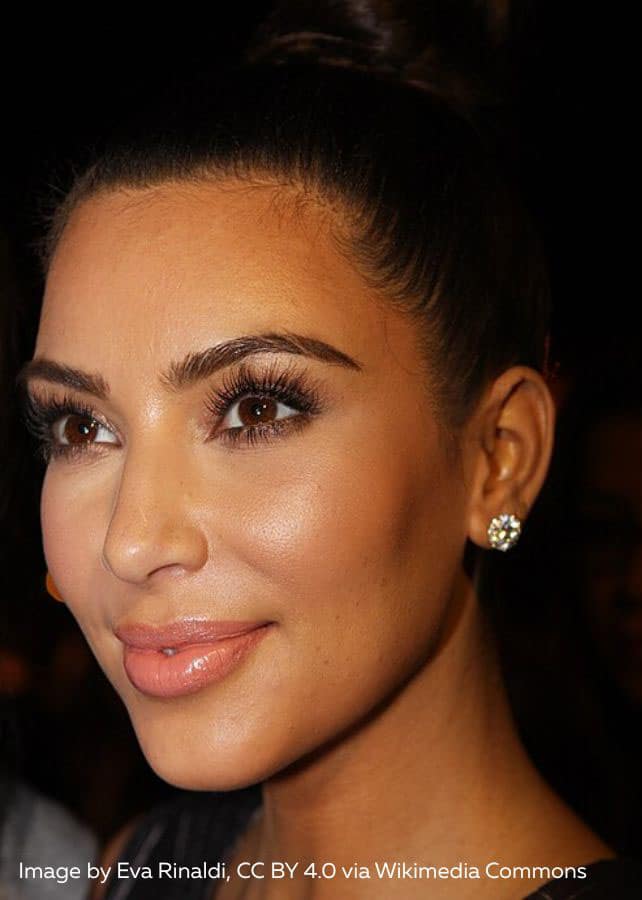 Kim Kardashian Salmon Sperm Facial. Polynucleotide injections