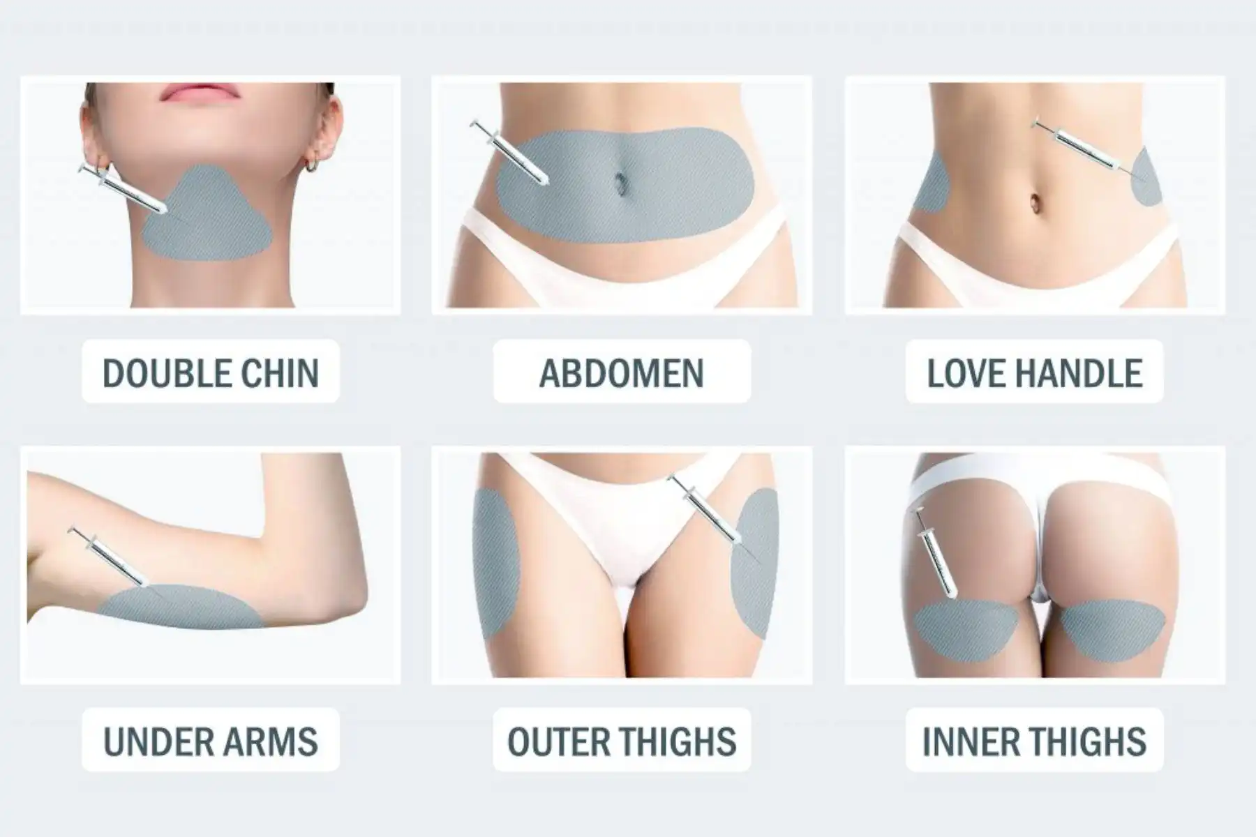 Aqualyx Fat Dissolving Injections treatment areas