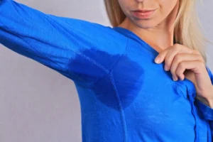 Treatment for Excessive Sweating (Hyperhidrosis)
