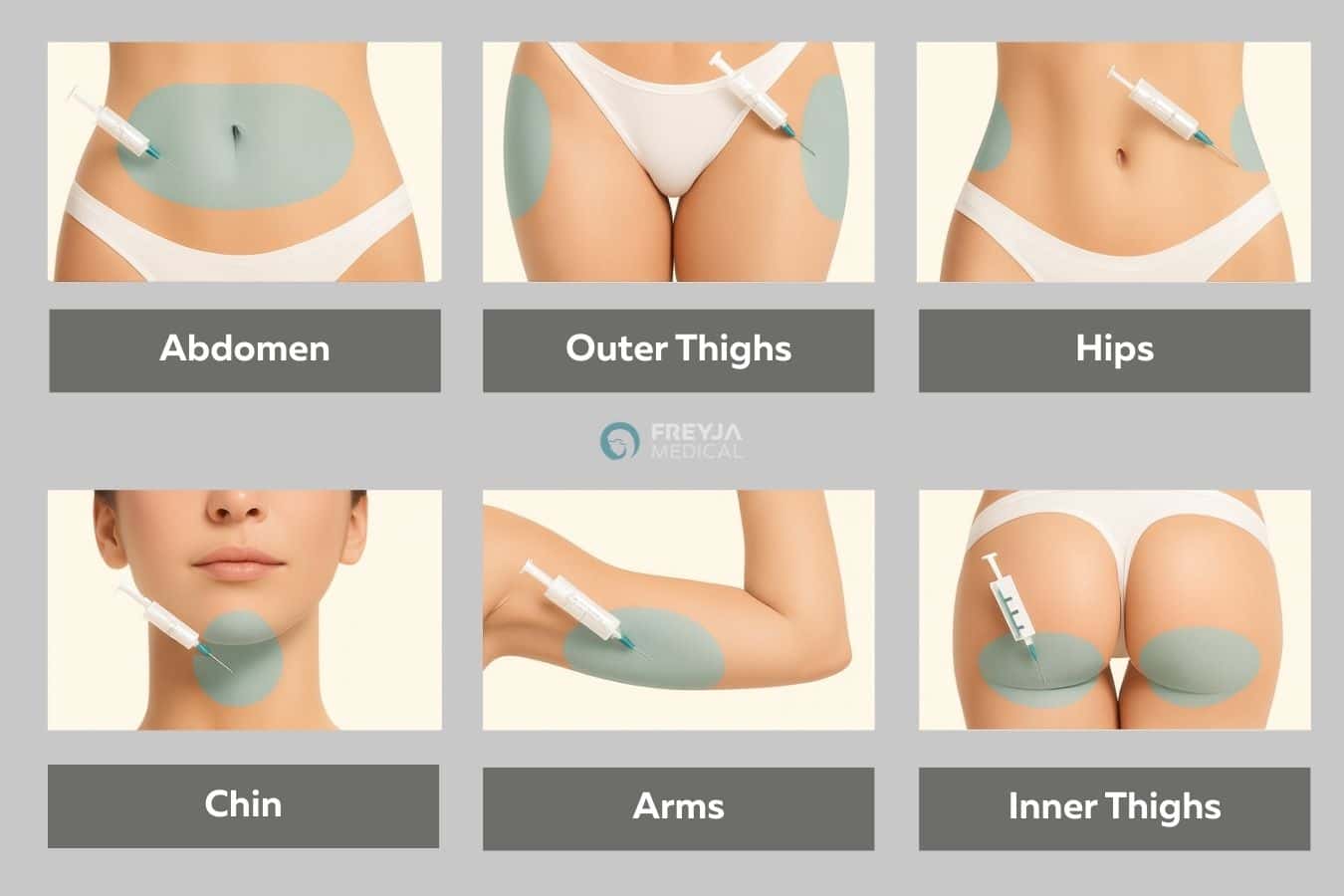 Aqualyx Fat Dissolving Injections treatment areas