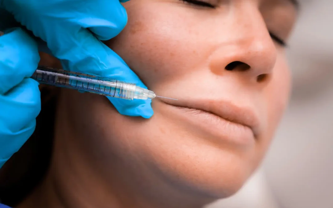 Lip Filler Essentials: Dermal Enhancement Guide