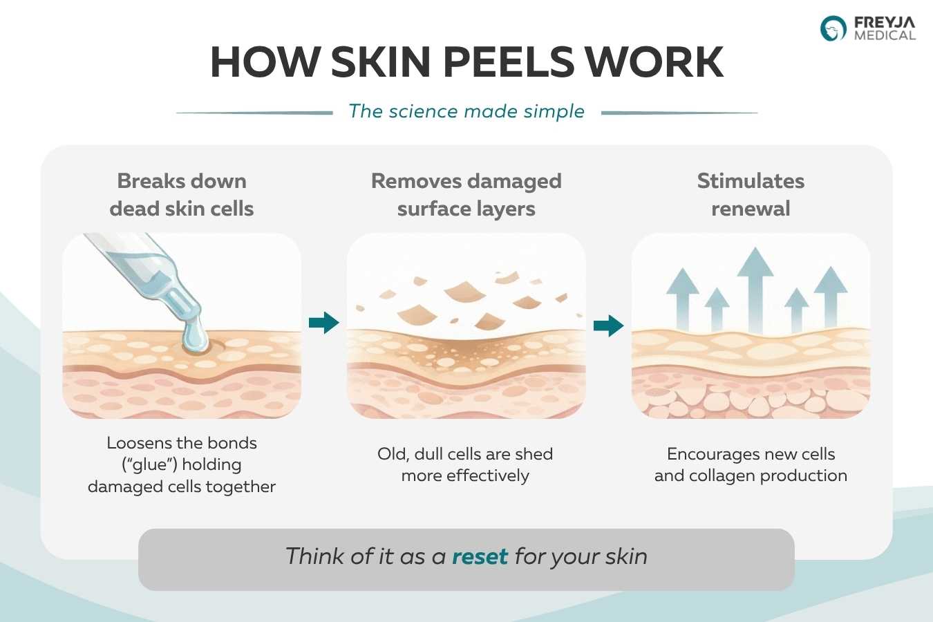 Illustration showing how skin peels work by breaking down dead skin cells, removing damaged surface layers, and stimulating skin renewal and collagen production.