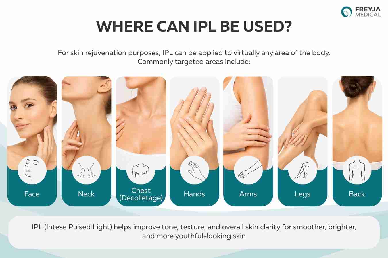 Where can IPL be used
